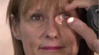 Ophthalmics Video 6  Eye Exam [upl. by Antonio]