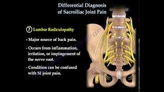 Differential Diagnosis of SI Joint Pain  Everything You Need To Know  Dr Nabil Ebraheim [upl. by Ditzel]