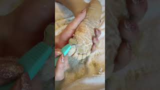 Full foot callus removal  Epidermolytic Palmoplantar Keratoderma  Jan 30 2023 [upl. by Garber]