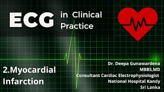 Analysis of ECGs in Myocardial Infarction  Lesson 2 [upl. by Dlnaod]