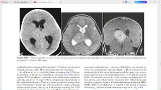 PAEDIATRIC IMAGING [upl. by Yras615]