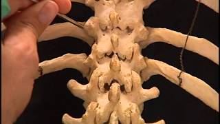 Video 4 Extrapedicular thoracic [upl. by Veno]