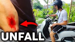 DAS WAR KNAPP Roller Unfall in Bali [upl. by Head143]