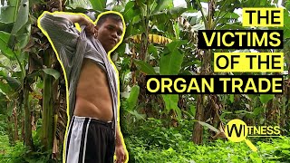 Organ Thieves Inside the Dark World of Organ Trafficking  Organ Trade Documentary [upl. by Eeladnerb]