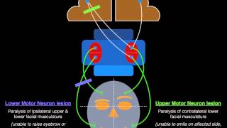 Facial Palsy Upper and Lower Motor Neuron Lesions  Dr MDM [upl. by Katherin]