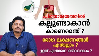 പിത്തസഞ്ചിയിലെ കല്ലുകൾ ഉണ്ടാവുന്നത് എങ്ങനെ  ഇത് എങ്ങനെ ഒഴിവാക്കാം  pithashaya kallu maran [upl. by Phenice]