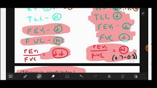 SPIROMETRY  Obstructive Vs Restrictive Lung Diseases  EASY Explained and Mnemonics  neetpg [upl. by Eelsel780]