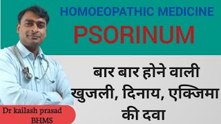 psorinum homoeopathic remedies [upl. by Moore]