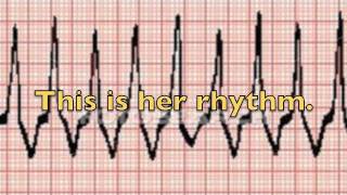 ACLS Megacode Simulation Two [upl. by Eckhardt684]