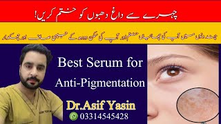 Best Serum for MelasmaPigmentationfreckles in the world Melasma management and treatmentserum [upl. by Reggie]