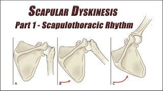 Fix Your Scapular Dyskinesis Part 1  Scapulothoracic Rhythm Exercises [upl. by Blondell188]