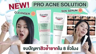 กูรูเช็ค EUCERIN SOS SERUM และ 3X Treatment Gel to Foam Cleanser จบทุกสิวซ้ำซาก ใน 8 ชม [upl. by Hniv]