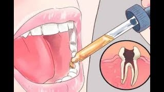 12 Simple Home Remedies for Toothache Pain Relief  Health Tips [upl. by Asiralc]