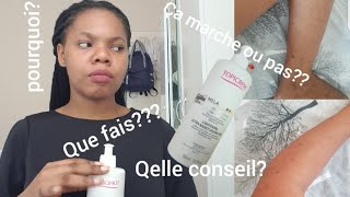 lévolution de ma peau avec Topicrem mela  début dutilisation [upl. by Arihs]