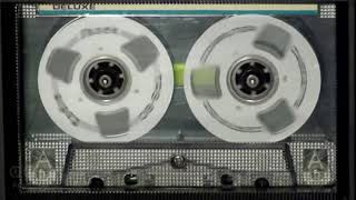 Yeshimebet Dubale የሺመቤት ዱባለ ጐዳናው ምን ይላል Ethiopian Music Oldies [upl. by Hadwyn102]