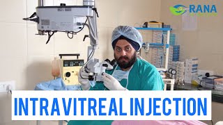 Understanding Intravitreal Injections A Comprehensive Guide to Eye Health [upl. by Aitercul]