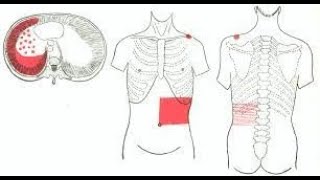 Why Pleurisy pain  Pleuritis pain is referred to the anterior abdominal wall [upl. by Limoli]