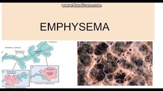 Emphysema Types Pathogenesis and morphology [upl. by Coster]