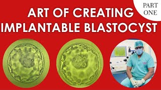 BLASTOCYST 4AA 5AA blastocysttransfer blastocystgrading embryotransfer successful PREGNANCY [upl. by Nilra]