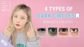 How to Remove Dark Circles Under Eyes In The Most Effective Way  Teen Beauty Bible [upl. by Otsirave509]