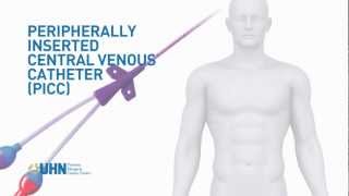 Learn About the Peripherally Inserted Central Venous Catheter PICC [upl. by Jefferson954]