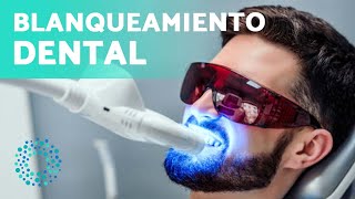 4 Tipos de BLANQUEAMIENTOS DENTALES 🦷 ¿Funciona el Blanqueamiento Dental [upl. by Truscott]