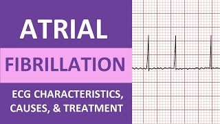 Atrial Fibrillation AFib ECG Treatment Causes Nursing NCLEX Review ACLS [upl. by Doralynn]