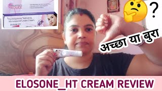 ELOSONE  HT Skin cream reviewक्या सच में dark spots दूर करती हैं [upl. by Willner]