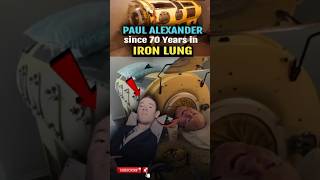 Paul Alexander last polio survivor in iron lungs 🫁 70years 🤯😱 youtube facts youtubeshorts [upl. by Eetsim888]