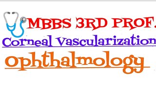 Corneal VascularizationOphthalmologyMBBS 3rd ProfNotes mbbs [upl. by Nnaitsirk]