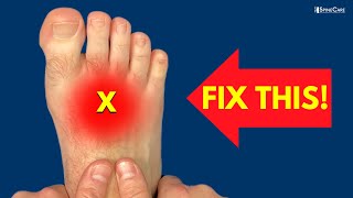 How to Fix Pain on the TOP of the Foot [upl. by Atter905]