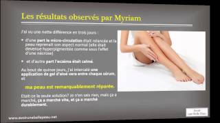 Enlever une cicatrice  le témoignage impressionnant de Myriam [upl. by Defant]