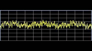 Inflammation  Rife Frequencies [upl. by Neyuh]