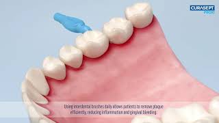 Jak używać szczoteczek międzyzębowych Curasept [upl. by Valma]
