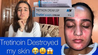 Quitting Tretinoin  Tretinoin destroyed my skin😭😫 [upl. by Mezoff892]