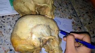 MENINGES OF SKULL dura matter easy explanation part 2 [upl. by Sonitnatsnok]