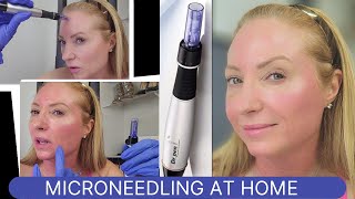 How to use Microneedle at Home with Dr Pen [upl. by Ripleigh]