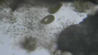 Observation de microorganismes algue verte infusoire mare microscope X4 et X10 [upl. by Sev]