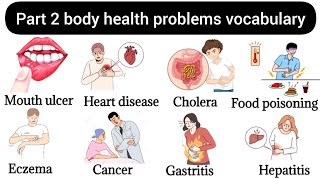 Part 2 Body Health Problems  Illness Body Pain Vocabulary  English Vocabulary Verbs [upl. by Zachar]