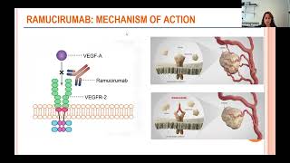 Clinical Trials for Thymic Tumors 2024 Update [upl. by Sethi]