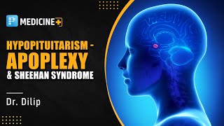 Hypopituitarism  Apoplexy amp Sheehan Syndrome by Dr Dilip  PrepLadder NEET SS [upl. by Eniroc]