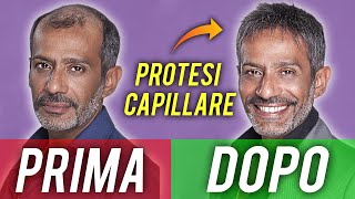 LA PROTESI MI HA CAMBIATO LA VITA  la storia di SIMONE FRATINI [upl. by Clementia]