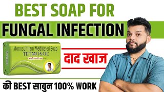 दाद खुजली के लिए बेस्ट साबुन  Tetmosol Soap Review Hindi  Gyanear The Medical Channel [upl. by Sachsse]