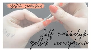 GELLAK VERWIJDEREN  Uitgebreide uitleg  Gellak Nederland [upl. by Berga677]