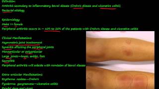 100P  Enteropathic Arthropathy [upl. by Dnalwor508]