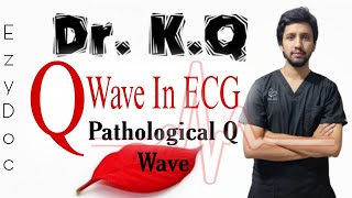 Q wave in ECG Pathological Q WaveDeep Q waves on ECGDrKQ [upl. by Nodyarg]