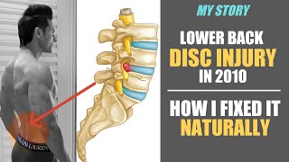 My Lower Back Disc Injury in 2010  How I Fixed it NATURALLY Guru Mann [upl. by Lledniw411]