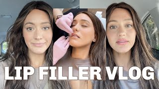 LIP FILLER VLOG  Before and after  the healing process [upl. by Reilly]