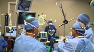 Shoulder Surgery Arthroscopy OR Setup and Patient Positioning [upl. by Jase]