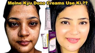 Glyco 6 vs Tretinoin Why I Decided to Use Both for Maximum Results  Indian Youtuber Anmol [upl. by Gareri]